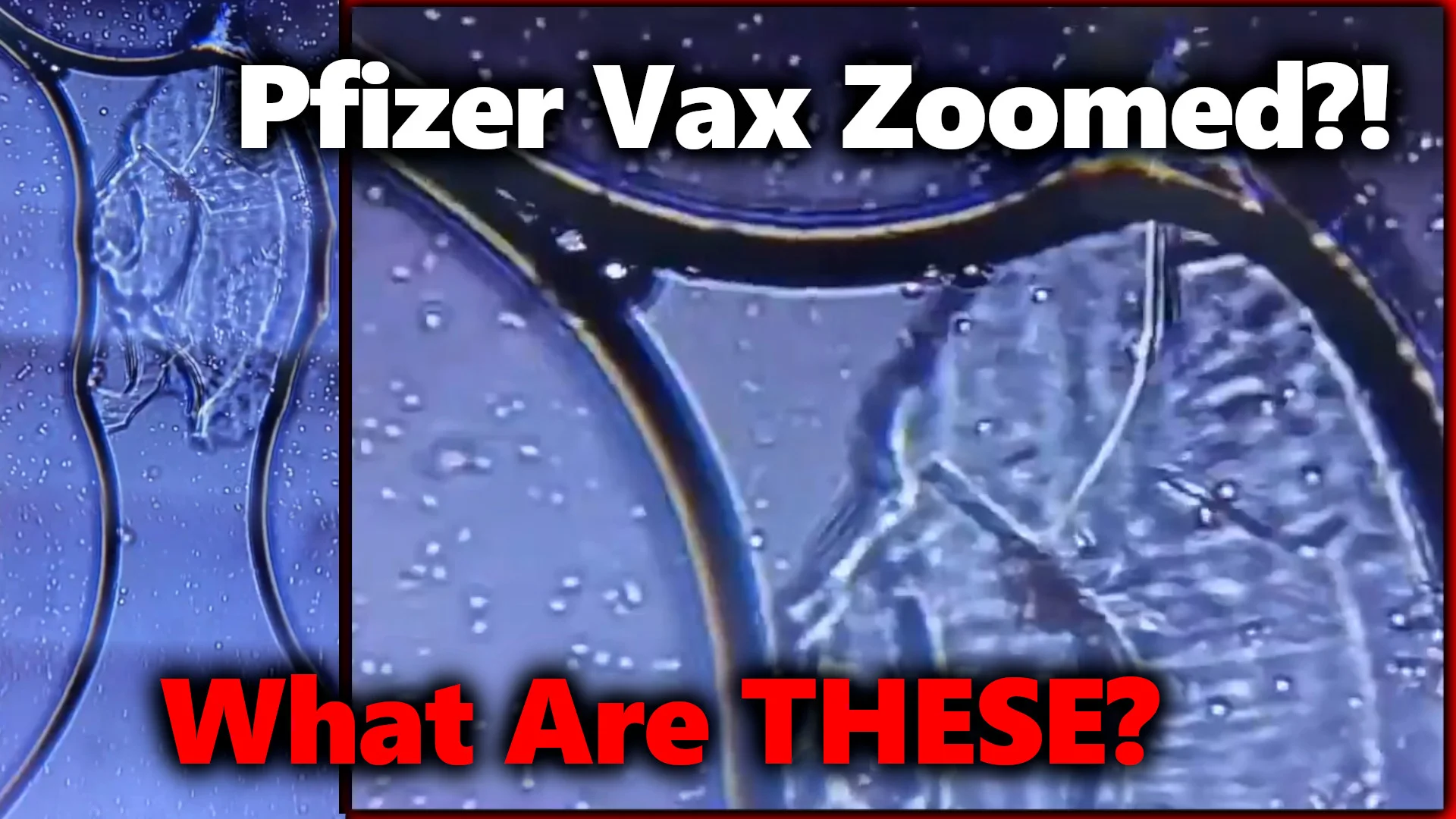 DISTURBING! Pfizer Vaccine Zoomed w/ Microscope?! Are Living Cells/ Organisms  Mixed In?!