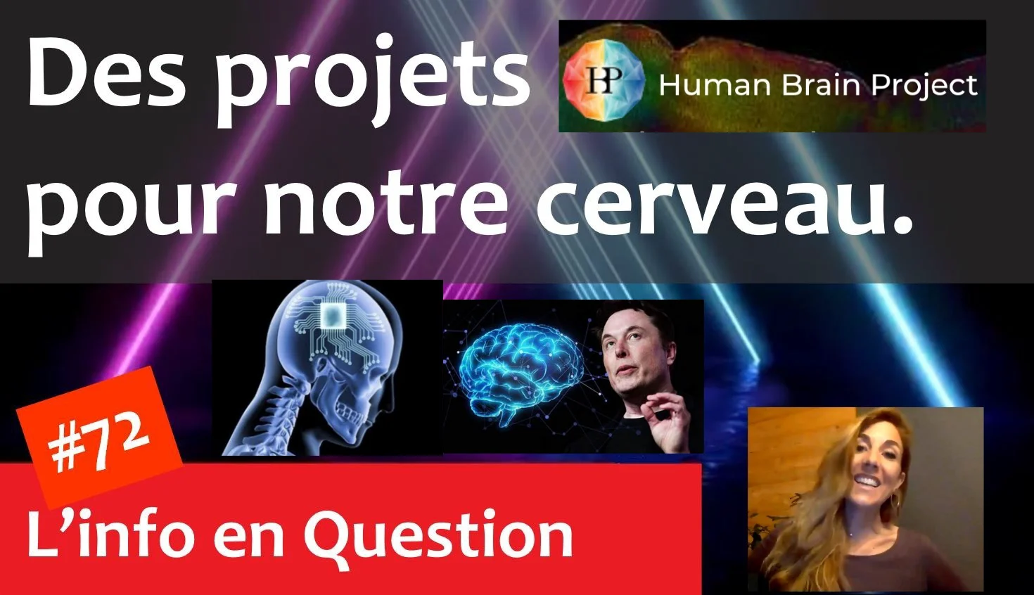 Human Brain Project & Neuralink – Des implants dans notre cerveau